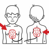 Philips OnSite Child AED Placement Guide
